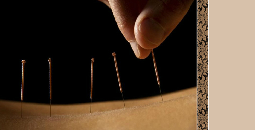 Acupuncture Columbia SC - Blue Root Health