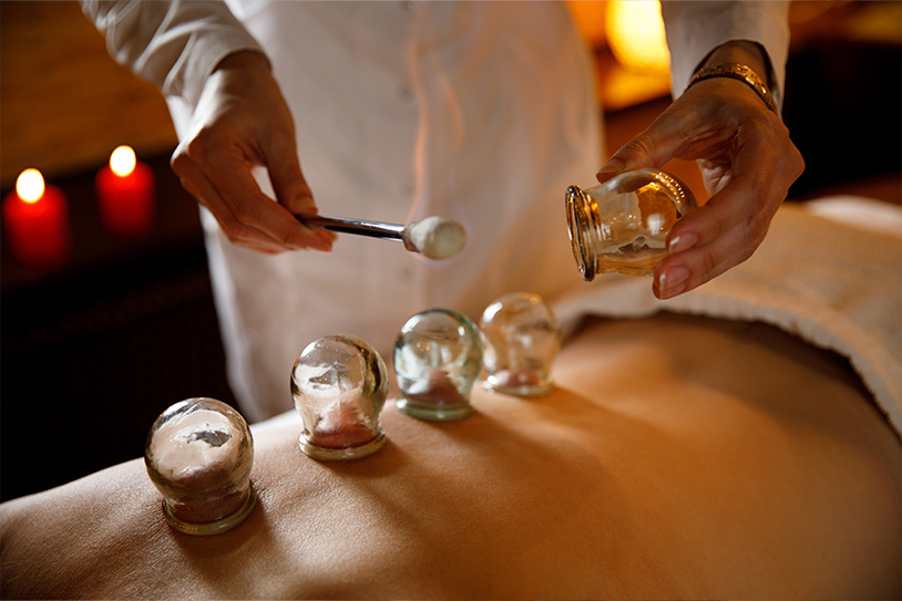 fire cupping treatment