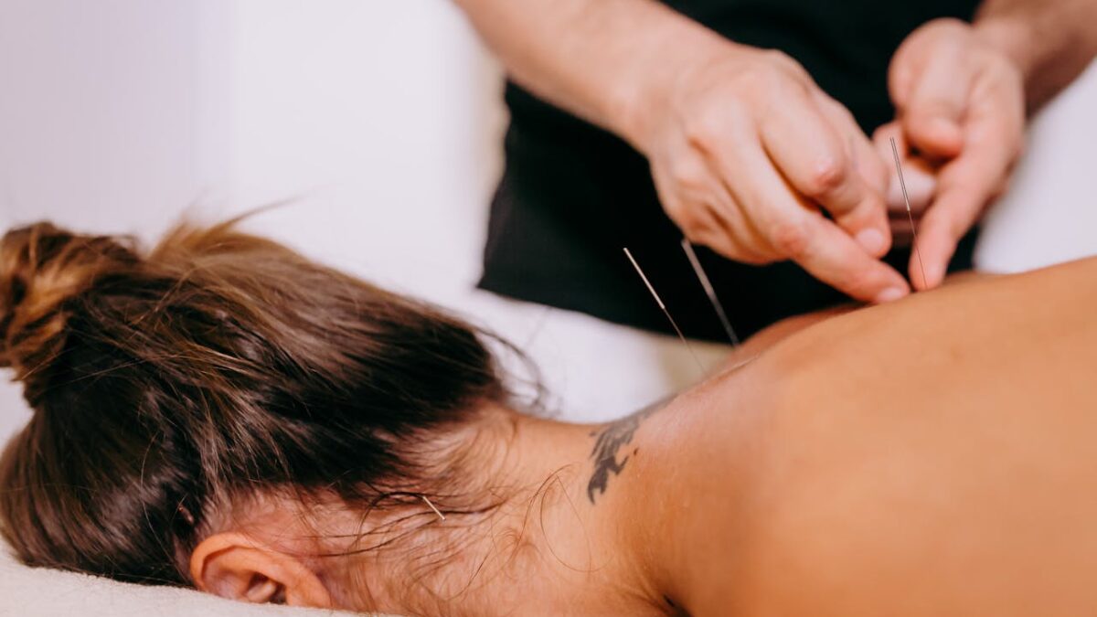 Acupuncture on back